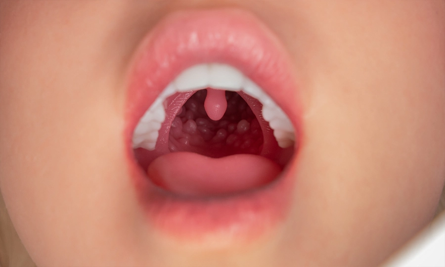 FANREAL Newly Upgraded ROS Sculpture with Movable Jaw