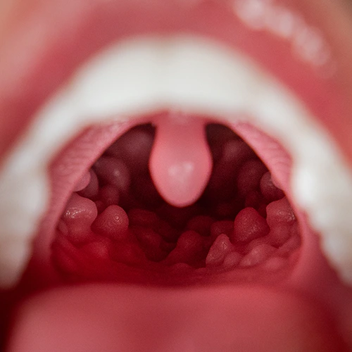 FANREAL Newly Upgraded ROS Sculpture with Movable Jaw