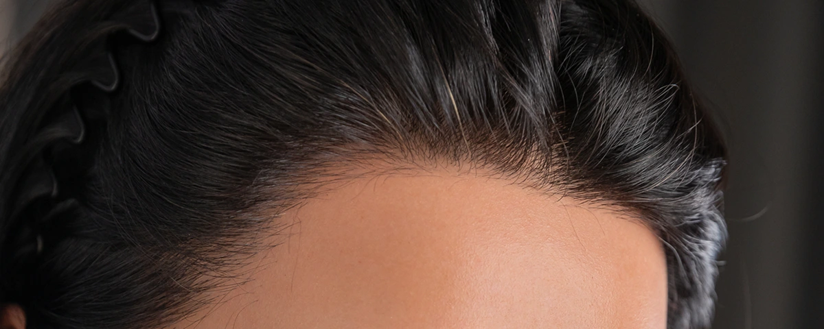 FANREAL Hair Implantation Technique